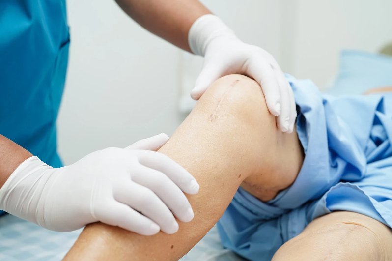 Affordable Knee Surgery Everything You Need to Know for Better Health and Savings