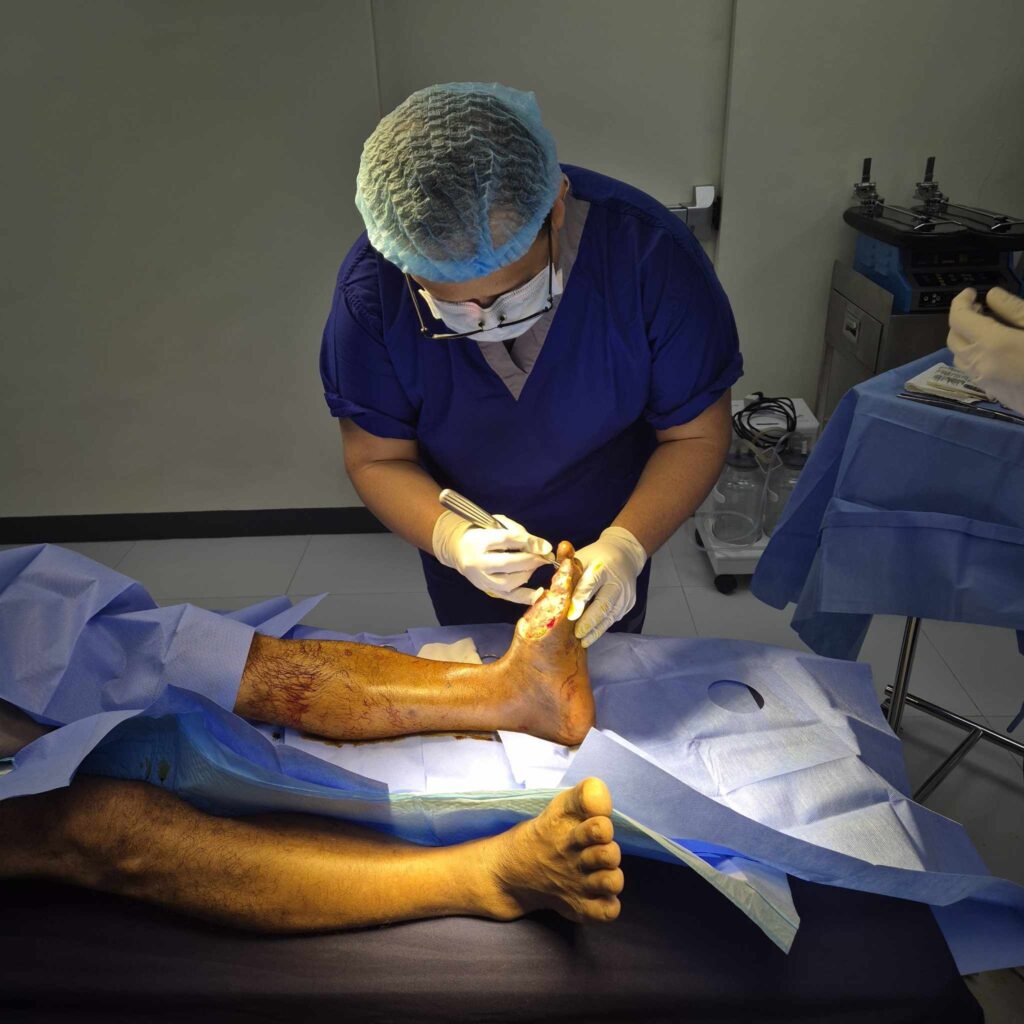 Expert Debridement Services in Quezon City Faster Recovery Through Specialized Care