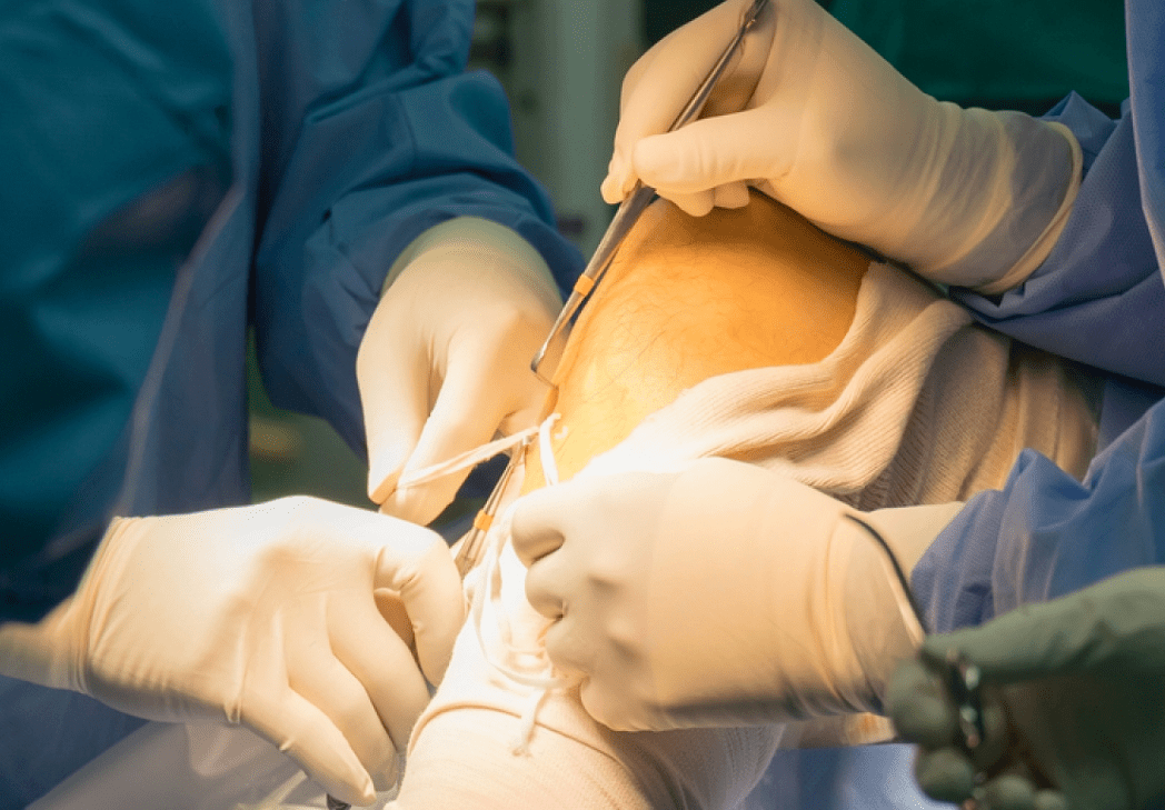 Orthopedic Consultation Quezon City Your Guide to Expert Care for Bone, Joint, and Muscle Health