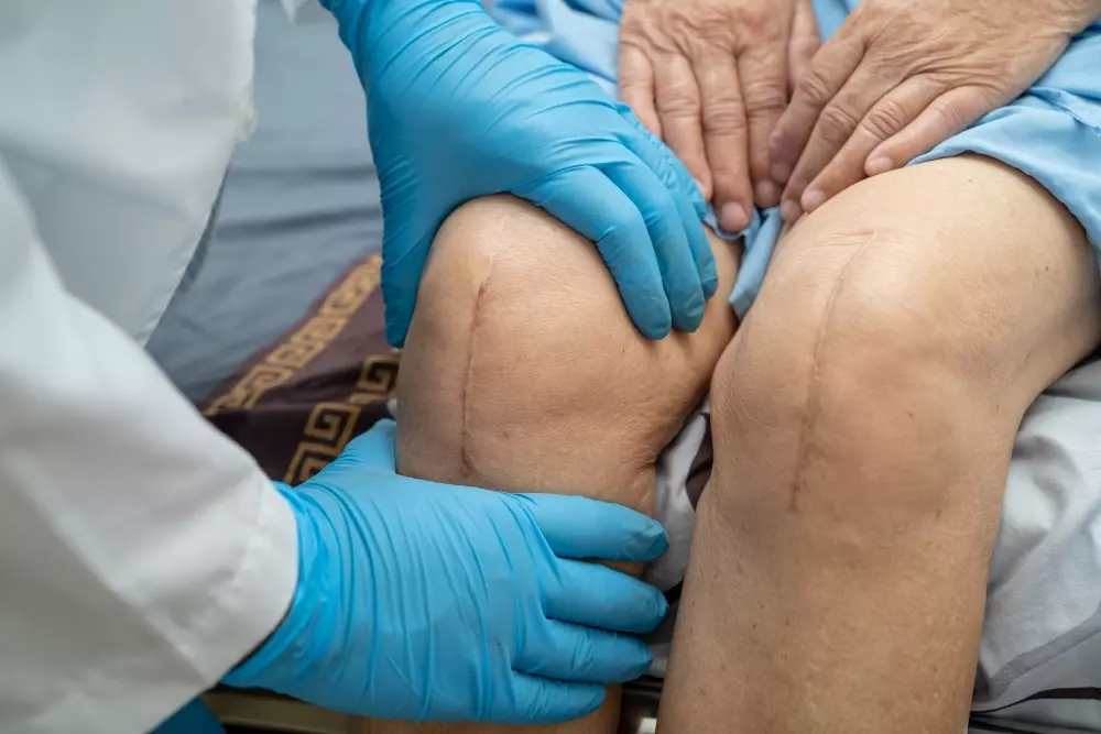 Total Knee Replacement Restoring Mobility and Enhancing Quality of Life
